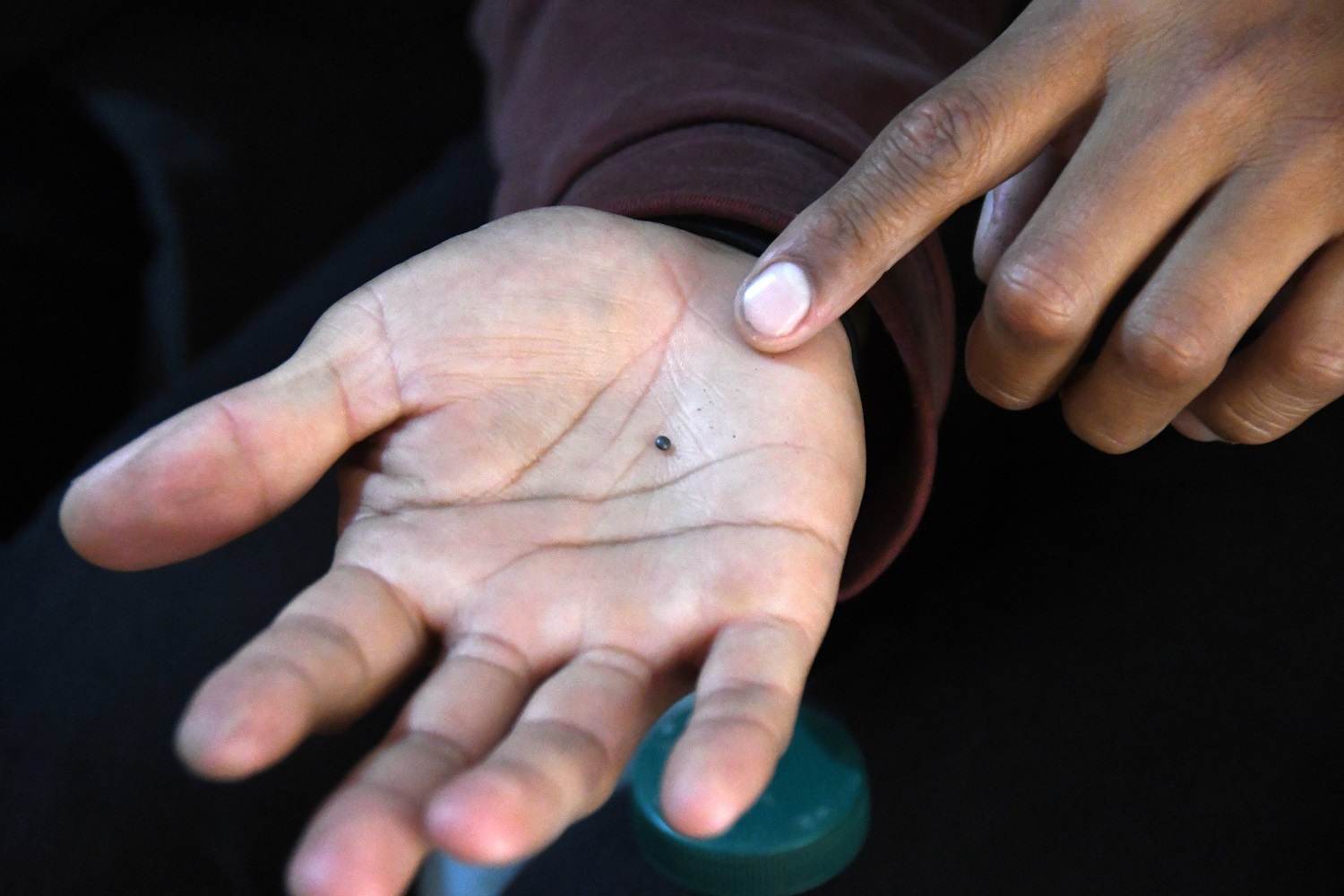 Este es uno de los perdigones que los médicos lograron retirarle a Franciso Tapia de su rostro | Foto: Carlos Granja / EL UNIVERSO