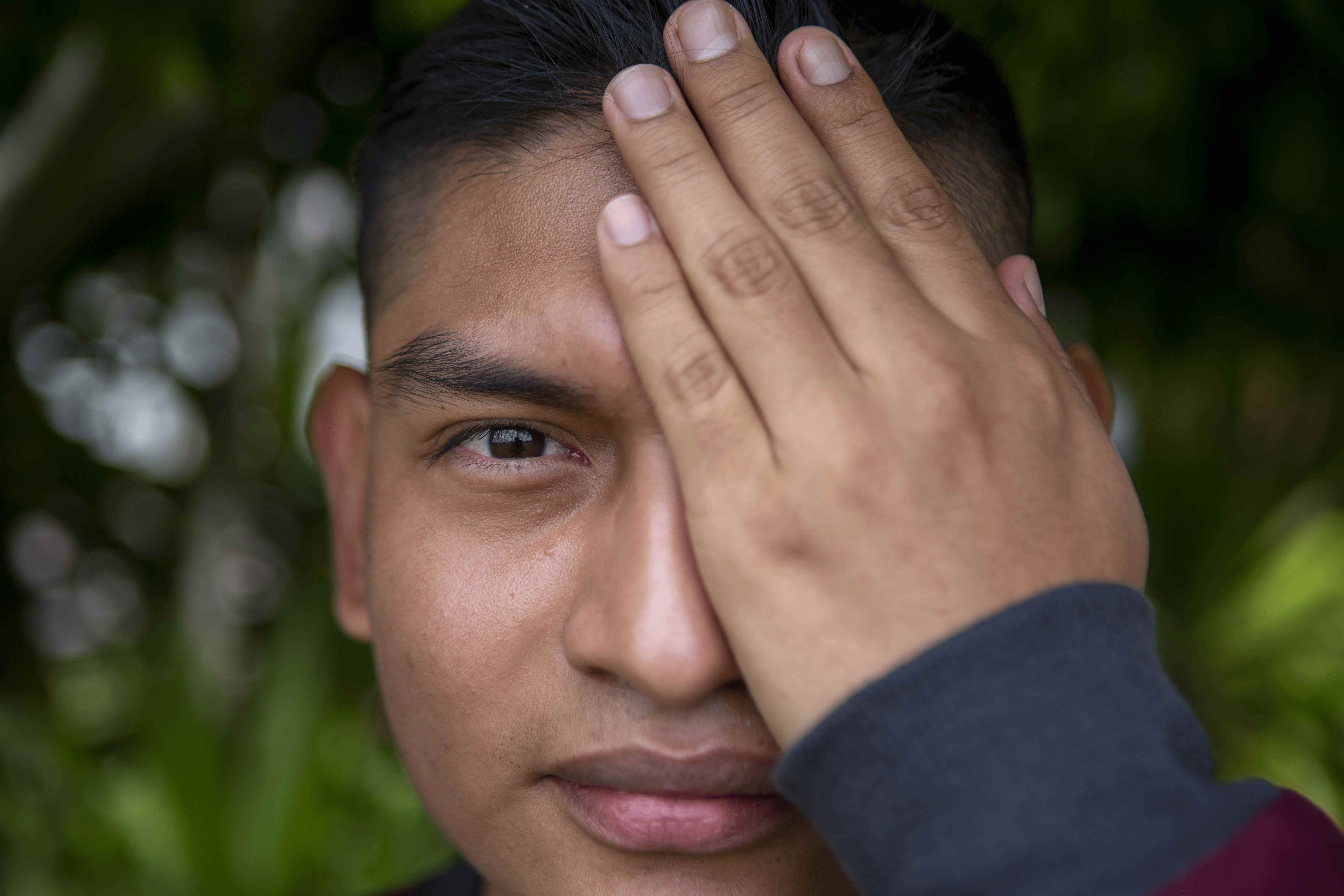 Kenneth, con una mano sobre su prótesis, posa para un retrato cerca de su casa tras una entrevista el 5 de mayo de 2022. | Foto: Oliver de Ros